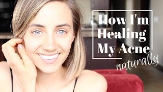 How Im Healing My Acne Naturally [upl. by Asyl]