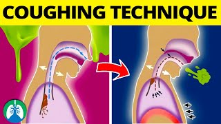 This COUGHING Technique Can Help Get Rid of Mucus and Phlegm ❗ [upl. by Elli]