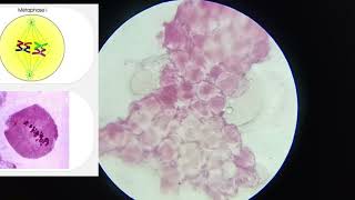 11th CLASS PRACTICAL  CELL DIVISION MEIOSIS 1 amp MEIOSIS 2  PROPHASE 5 STAGES  CBSE  GSEB bio [upl. by Polivy]