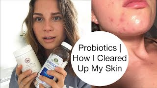 Probiotics  How I Cleared Up My Acne  Holistic Nutritionist Tips [upl. by Raskin]