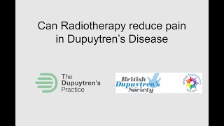 RT13 Does Dupuytrens Radiotherapy Reduce pain [upl. by Nessa]