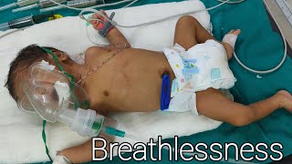 Breathing problem in Newborn babyBreathlessness amp Grunting newborn [upl. by Zeitler]