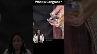 What is Gangrene [upl. by Welch]