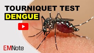 Dengue Fever and Tourniquet Test [upl. by Rinaldo]