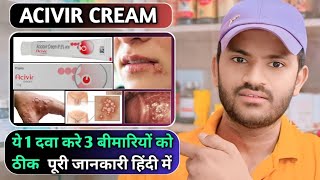 Acivir cream uses dose benefits and Side effects full review in hindihow to use acivir cream [upl. by Iztim]