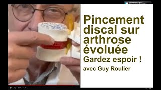 Pincement discal arthrose douloureuse gardez lespoir par Guy Roulier [upl. by Atiluj]