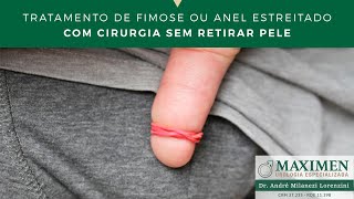 Como tratar fimose ou anel estreitado com cirurgia sem retirar pele [upl. by Elleinnad]