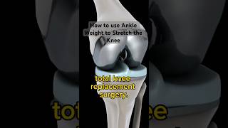 How to Stretch Total Knee Replacement with Ankle Weight [upl. by Irec]