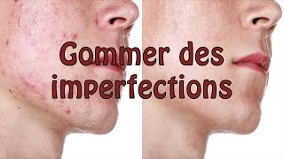 PHOTOSHOP Tutoriel  Gommer des imperfections acné etc dun visage [upl. by Publius]