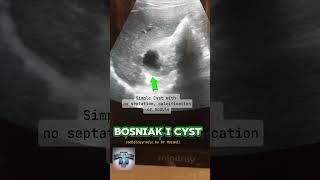 BOSNIAK I Cyst fy radiological fypyoutube radiologist science [upl. by Calesta96]