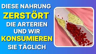 DIESES NAHRUNGSMITTEL ZERSTÖRT DIE ARTERIEN UND WIR ESSEN ES TÄGLICH 🆘 [upl. by Aicela]