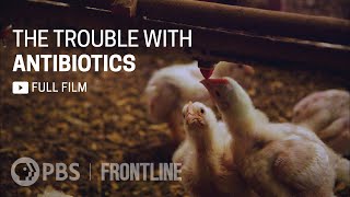 The Trouble with Antibiotics full documentary  FRONTLINE [upl. by Nas]