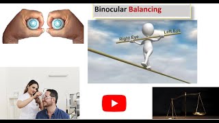 Mastering in Binocular Balancing by Alternate occlusion test [upl. by Anaujahs]